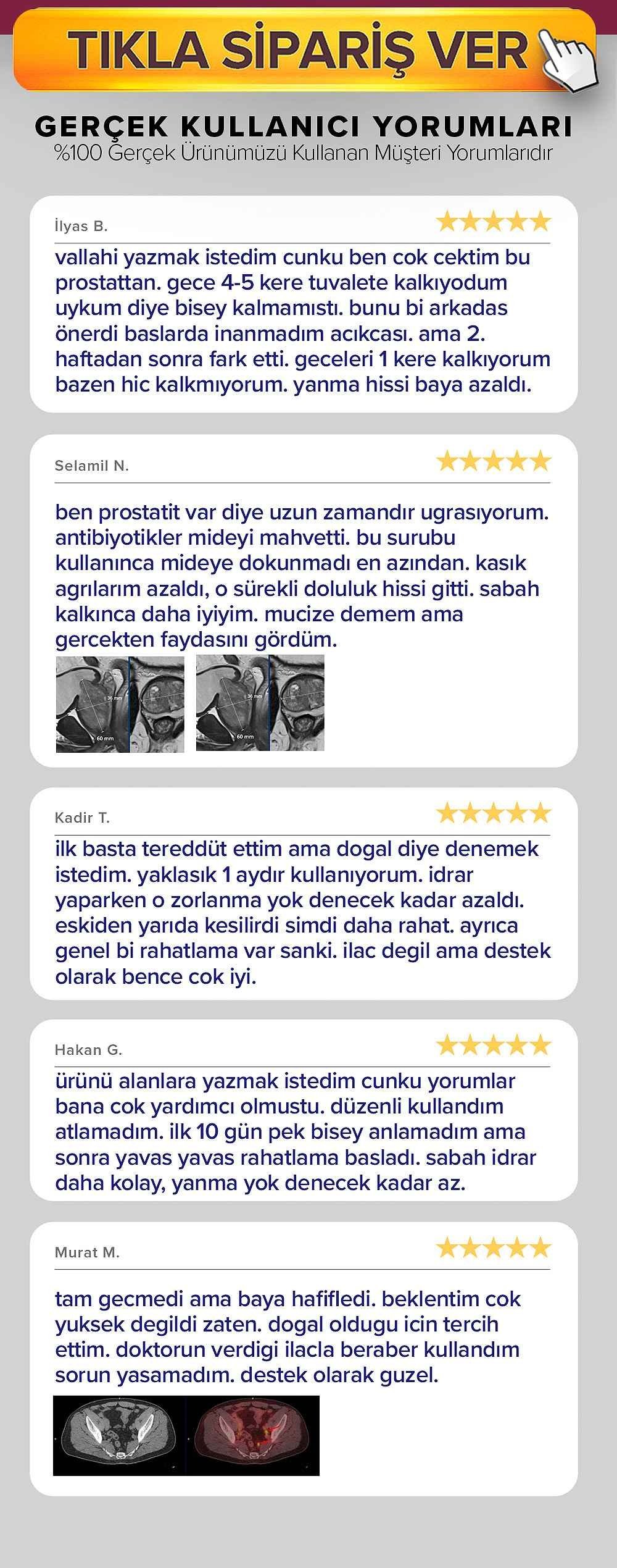 Referans kullanıcı yorumları